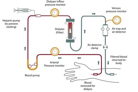 hardness test in dialysis|dialysis pump pressure gauge requirements.